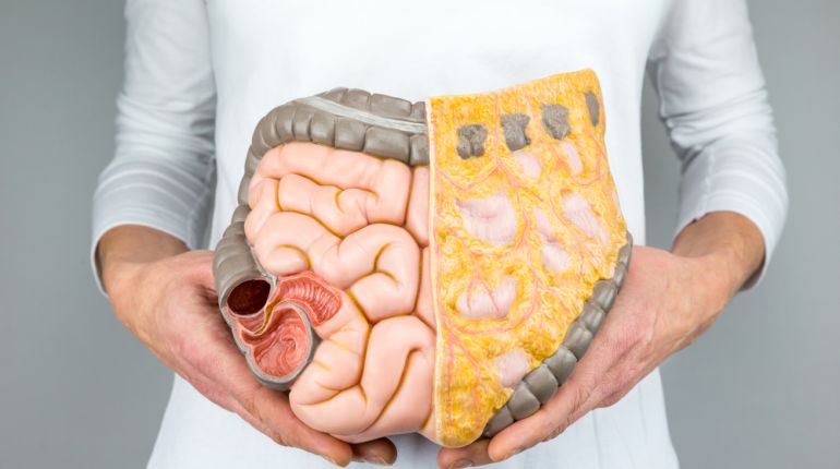 Kolorektální karcinom a antibiotika. Studie potvrdila, že existuje spojitost!   